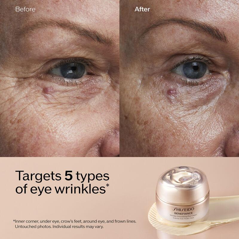 shs-concentrate-eye-wrinkle-cr-15ml